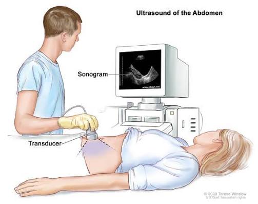 Ultrasonography